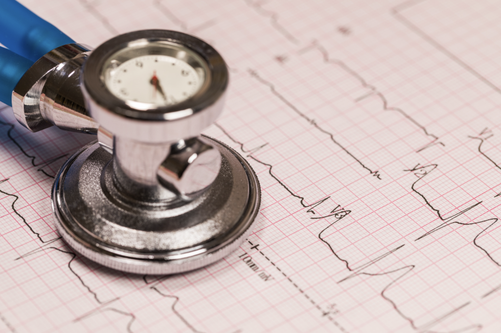 resting electrocardiogram