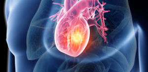 Arythmie cardiaque : Peut-on vivre normalement? Réponses d'experts