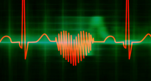 Palpitation cardiaque