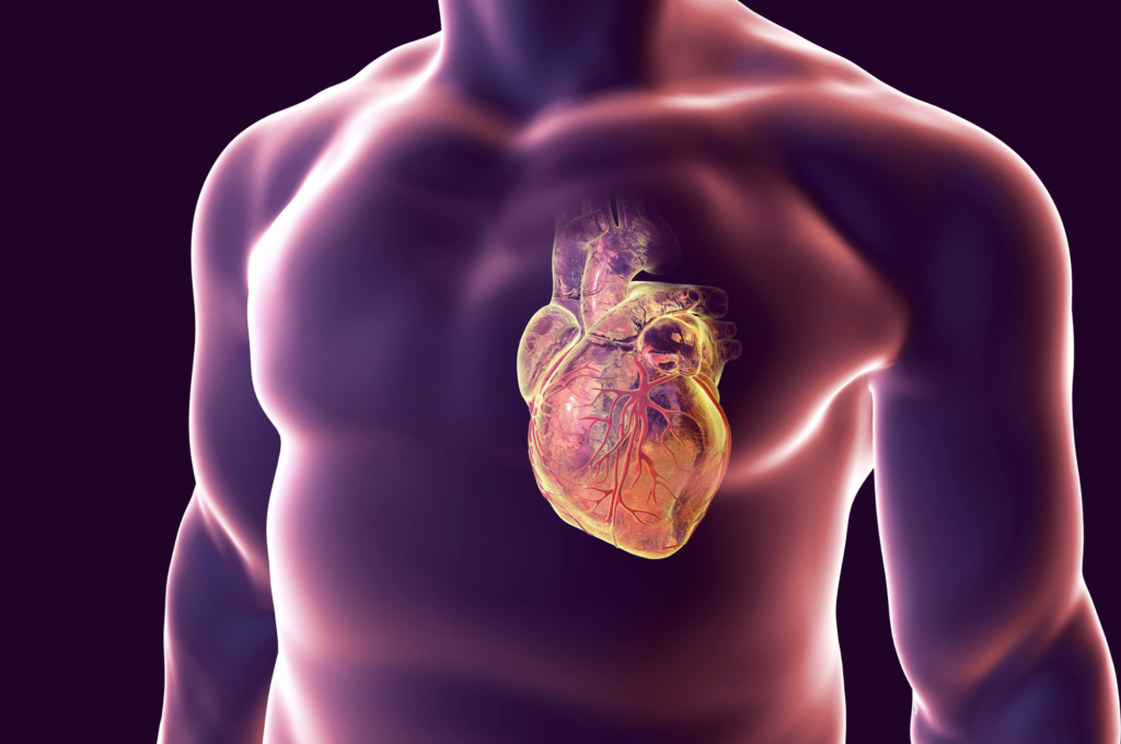 avc cardiaque